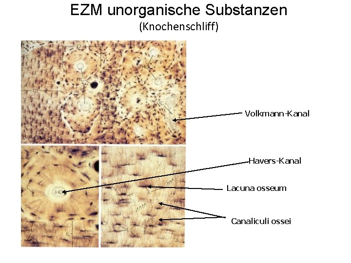 EZM unorganische Substanzen (Knochenschliff) Volkmann-Kanal Havers-Kanal Lacuna osseum Canaliculi ossei 