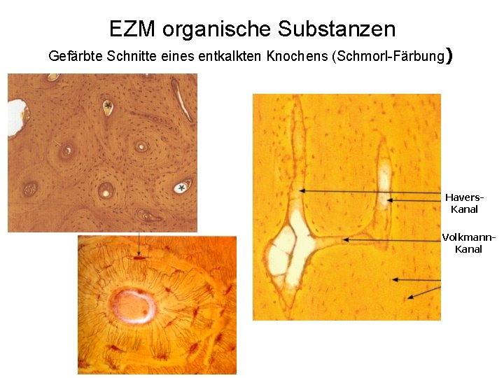 EZM organische Substanzen Gefärbte Schnitte eines entkalkten Knochens (Schmorl-Färbung) Havers. Kanal Volkmann. Kanal 