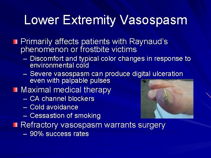 Lower Extremity Vasospasm Primarily affects patients with Raynaud’s phenomenon or frostbite victims – Discomfort