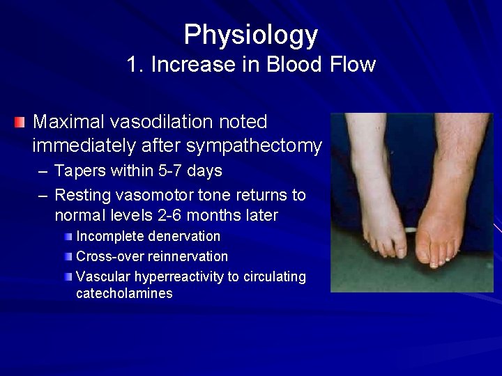 Physiology 1. Increase in Blood Flow Maximal vasodilation noted immediately after sympathectomy – Tapers