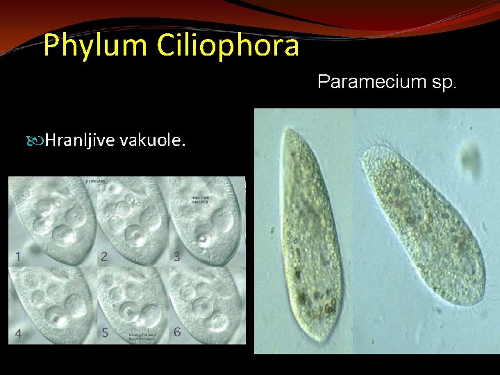 Phylum Ciliophora Paramecium sp. Hranljive vakuole. 
