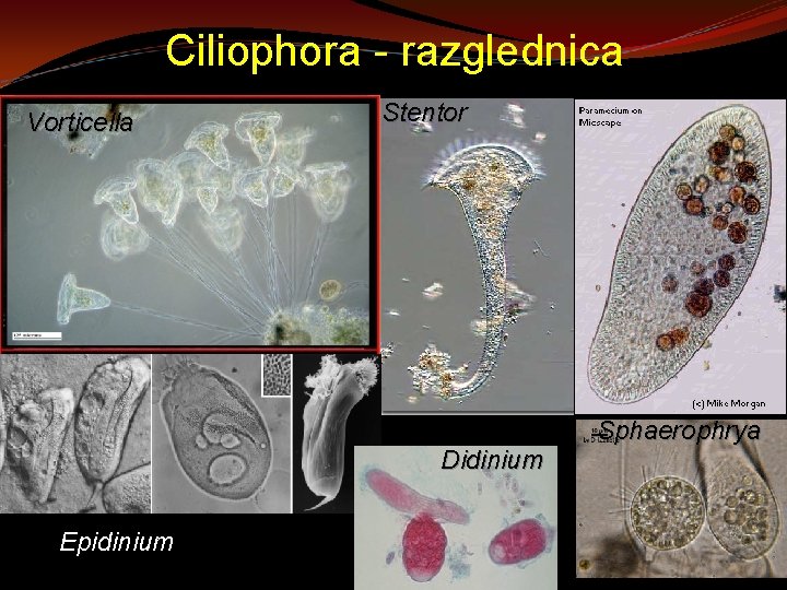 Ciliophora - razglednica Vorticella Stentor Didinium Epidinium Sphaerophrya 