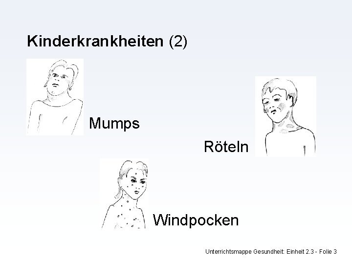 Kinderkrankheiten (2) Mumps Röteln Windpocken Unterrichtsmappe Gesundheit: Einheit 2. 3 - Folie 3 