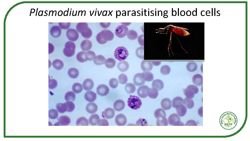 Plasmodium vivax parasitising blood cells 