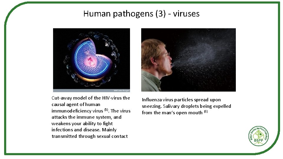 Human pathogens (3) - viruses Cut-away model of the HIV-virus the causal agent of