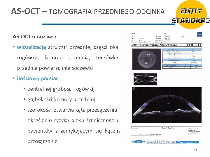 AS-OCT – TOMOGRAFIA PRZEDNIEGO ODCINKA ZŁOTY STANDARD AS-OCT umożliwia • wizualizację struktur przedniej części