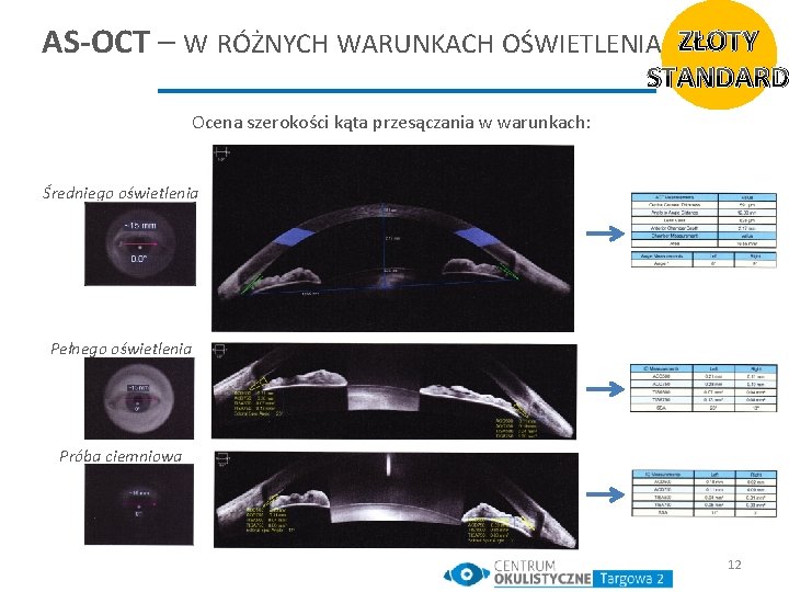 AS-OCT – W RÓŻNYCH WARUNKACH OŚWIETLENIA ZŁOTY STANDARD Ocena szerokości kąta przesączania w warunkach: