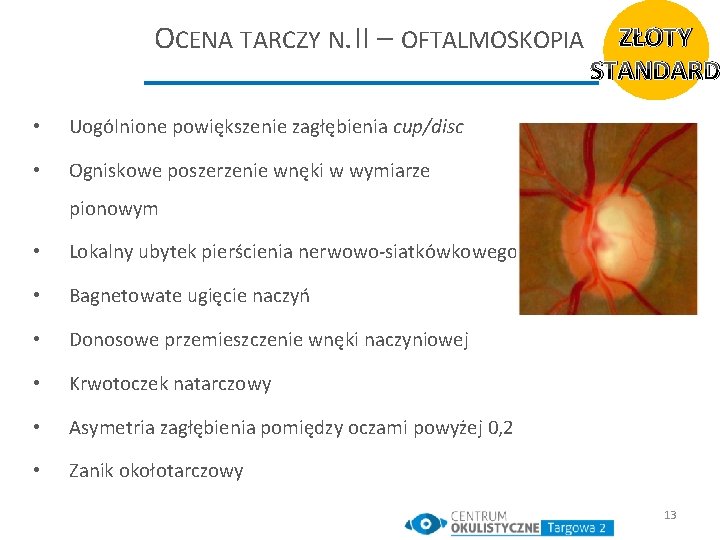 OCENA TARCZY N. II – OFTALMOSKOPIA • Uogólnione powiększenie zagłębienia cup/disc • Ogniskowe poszerzenie