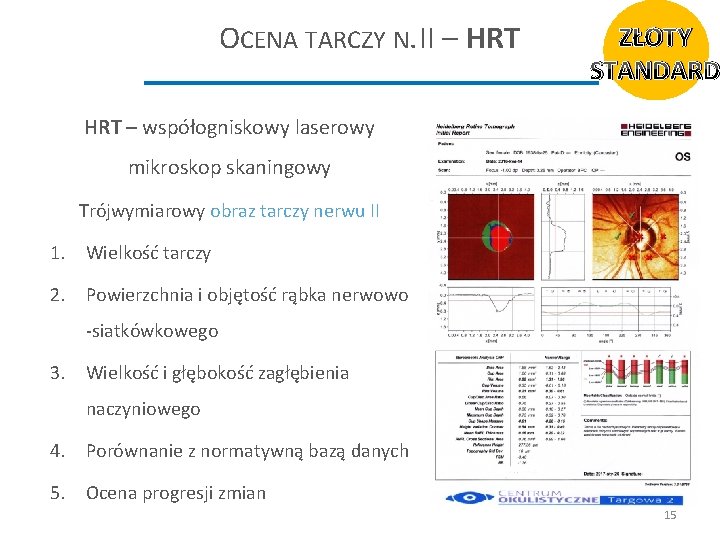OCENA TARCZY N. II – HRT ZŁOTY STANDARD HRT – współogniskowy laserowy mikroskop skaningowy
