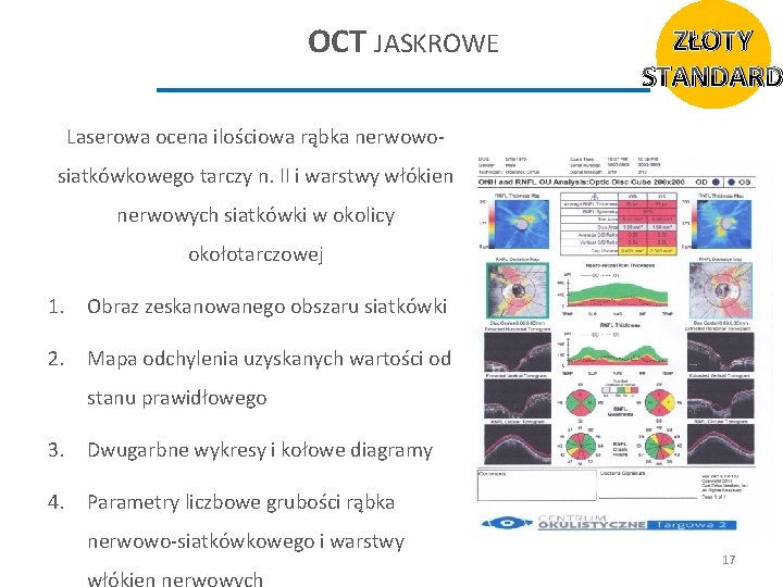 OCT JASKROWE ZŁOTY STANDARD Laserowa ocena ilościowa rąbka nerwowosiatkówkowego tarczy n. II i warstwy