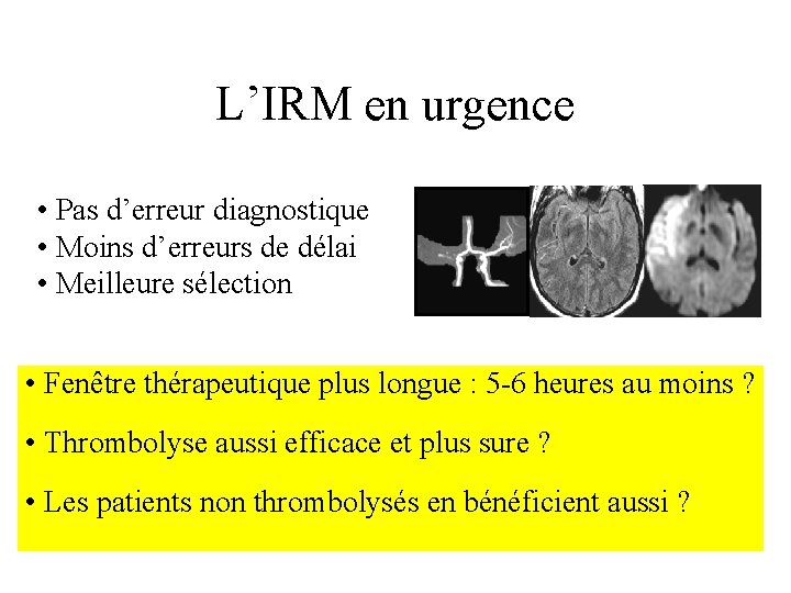 L’IRM en urgence • Pas d’erreur diagnostique • Moins d’erreurs de délai • Meilleure