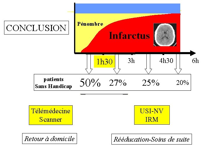 CONCLUSION Pénombre Infarctus 3 h 1 h 30 patients Sans Handicap 50% 27% 4