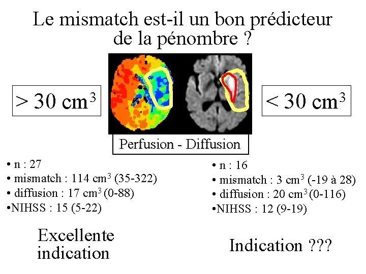 Le mismatch est-il un bon prédicteur de la pénombre ? > 30 cm 3