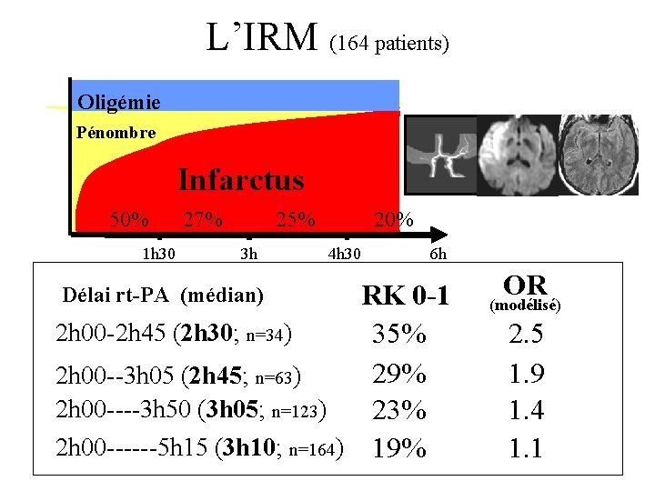 L’IRM (164 patients) Oligémie Pénombre Infarctus 50% 1 h 30 27% 25% 3 h