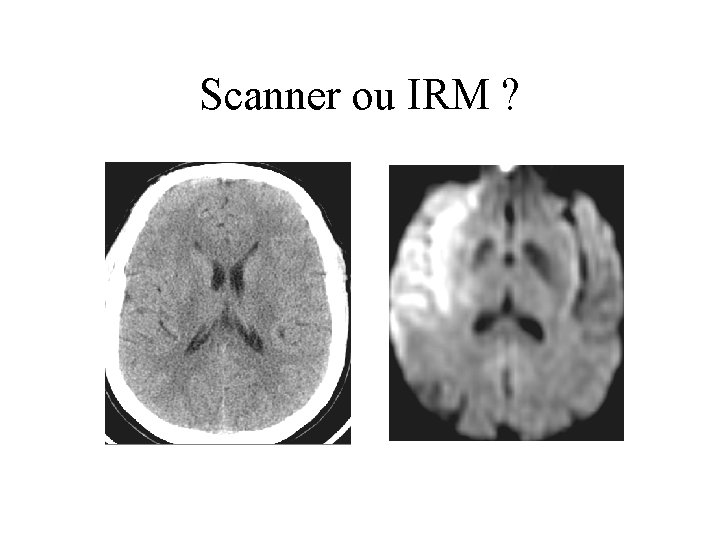 Scanner ou IRM ? 