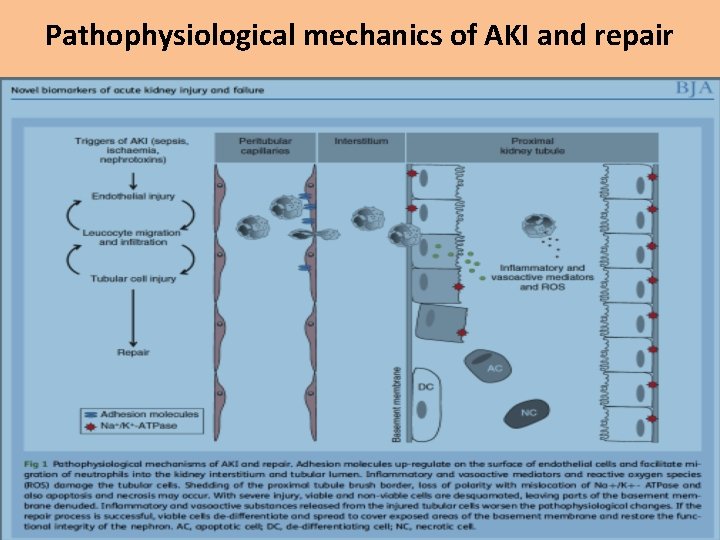 Pathophysiological mechanics of AKI and repair 