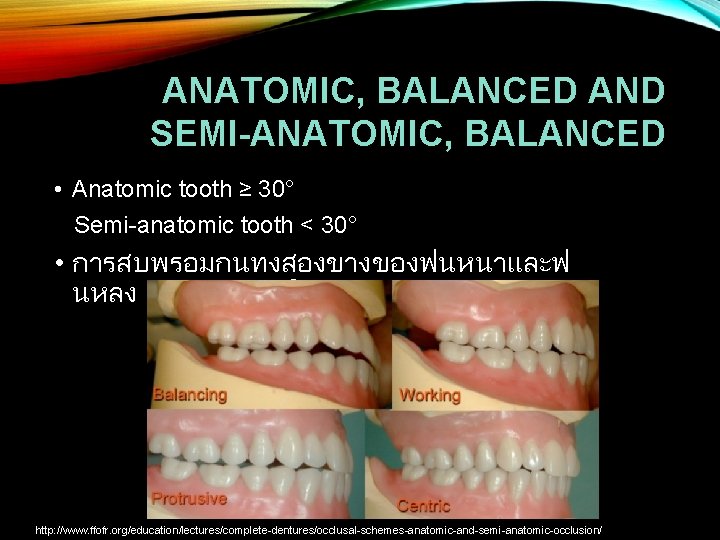 ANATOMIC, BALANCED AND SEMI-ANATOMIC, BALANCED • Anatomic tooth ≥ 30° Semi-anatomic tooth < 30°