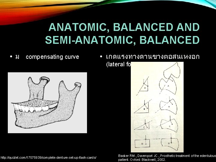 ANATOMIC, BALANCED AND SEMI-ANATOMIC, BALANCED • ม compensating curve • เกดแรงทางดานขางตอสนเหงอก (lateral force) http: