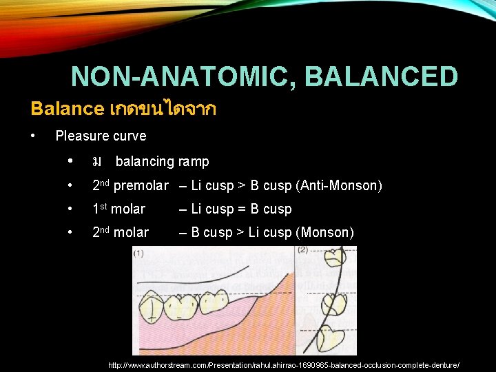 NON-ANATOMIC, BALANCED Balance เกดขนไดจาก • Pleasure curve • ม balancing ramp • 2 nd