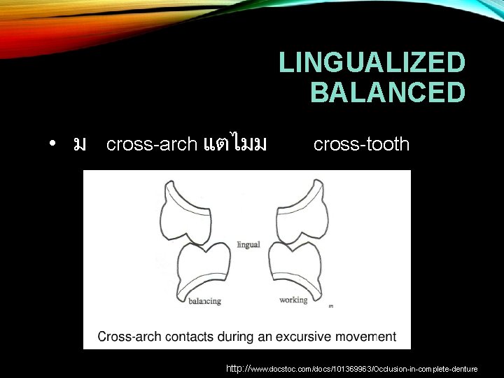 LINGUALIZED BALANCED • ม cross-arch แตไมม cross-tooth http: //www. docstoc. com/docs/101369963/Occlusion-in-complete-denture 