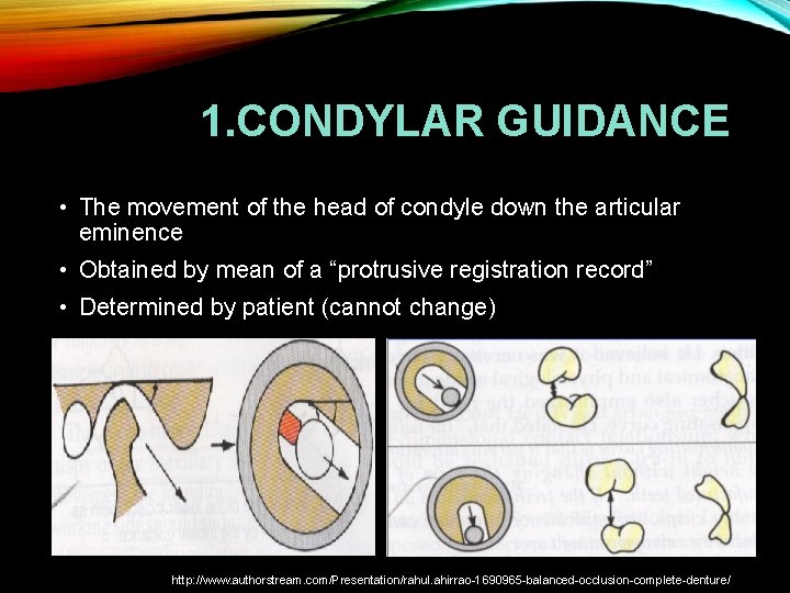 1. CONDYLAR GUIDANCE • The movement of the head of condyle down the articular