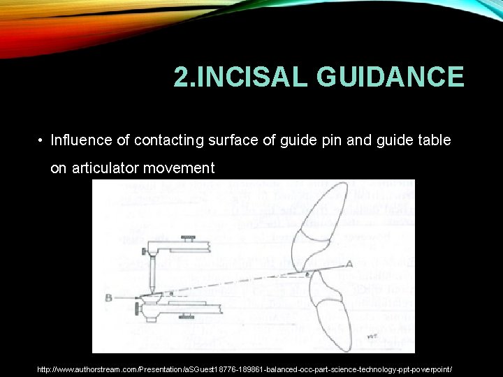 2. INCISAL GUIDANCE • Influence of contacting surface of guide pin and guide table