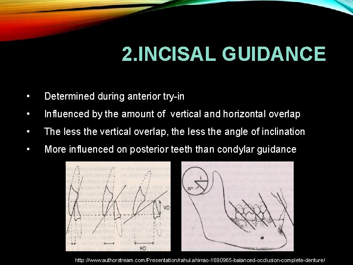 2. INCISAL GUIDANCE • Determined during anterior try-in • Influenced by the amount of