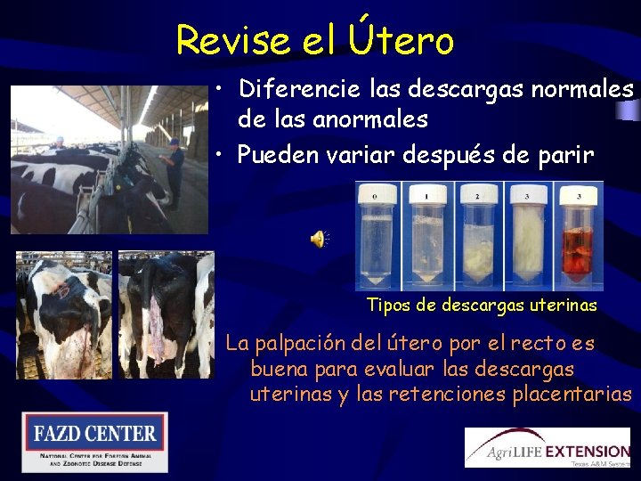 Revise el Útero • Diferencie las descargas normales de las anormales • Pueden variar