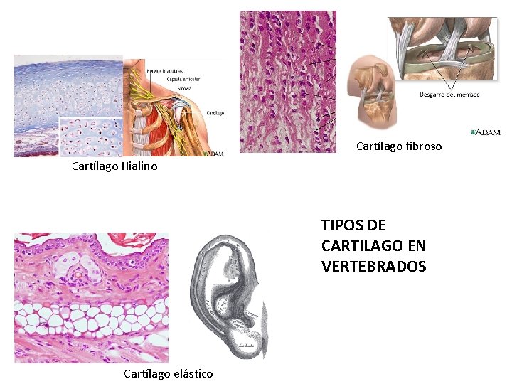 Cartílago fibroso Cartílago Hialino TIPOS DE CARTILAGO EN VERTEBRADOS Cartílago elástico 