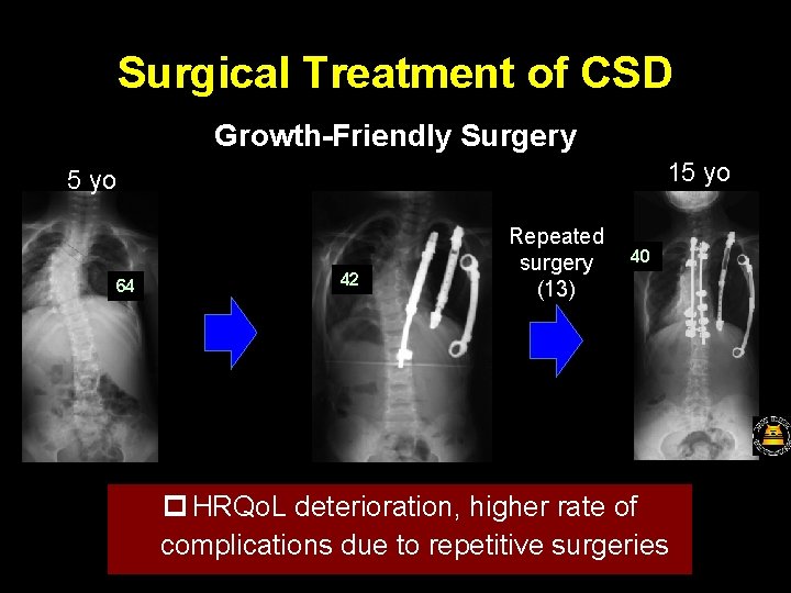 Surgical Treatment of CSD Growth-Friendly Surgery 15 yo 64 42 Repeated surgery (13) 40
