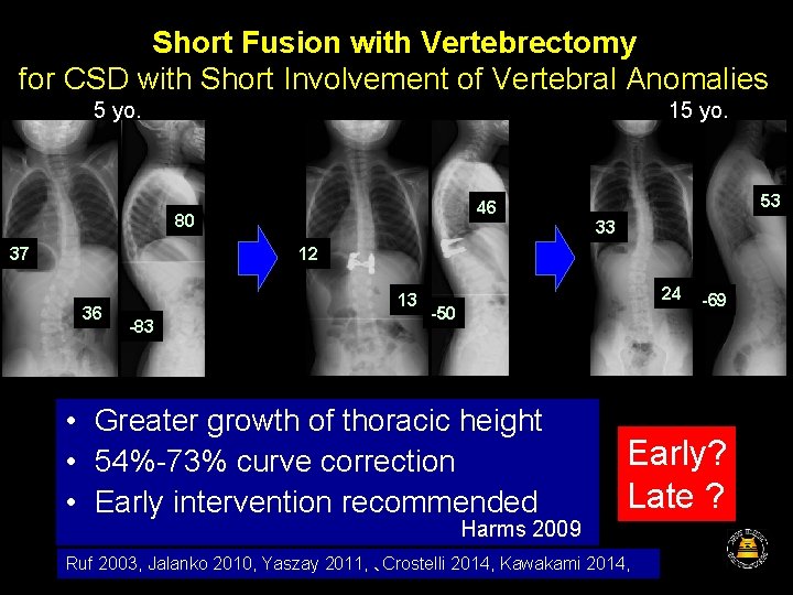 Short Fusion with Vertebrectomy for CSD with Short Involvement of Vertebral Anomalies 5 yo.