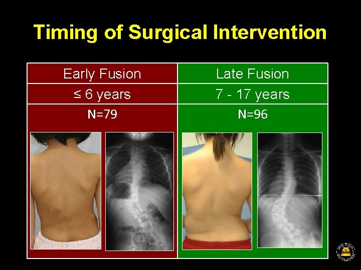 Timing of Surgical Intervention Early Fusion ≤ 6 years N=79 Late Fusion 7 -