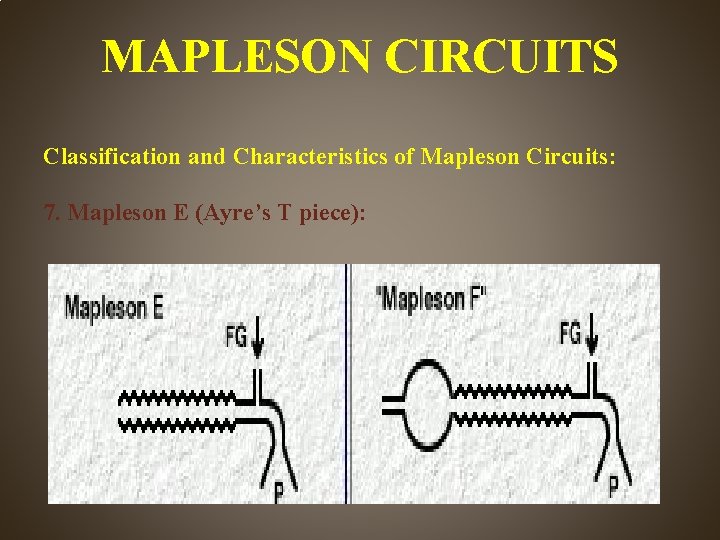 MAPLESON CIRCUITS Classification and Characteristics of Mapleson Circuits: 7. Mapleson E (Ayre’s T piece):