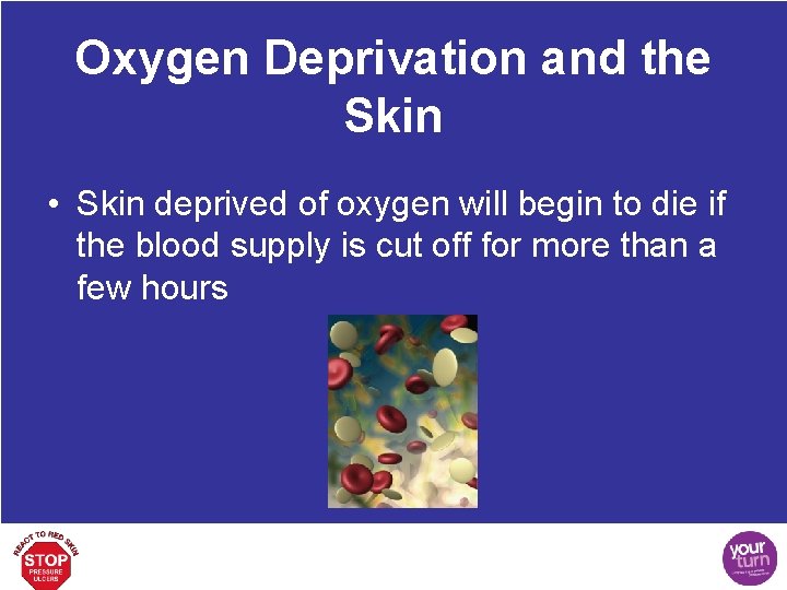 Oxygen Deprivation and the Skin • Skin deprived of oxygen will begin to die