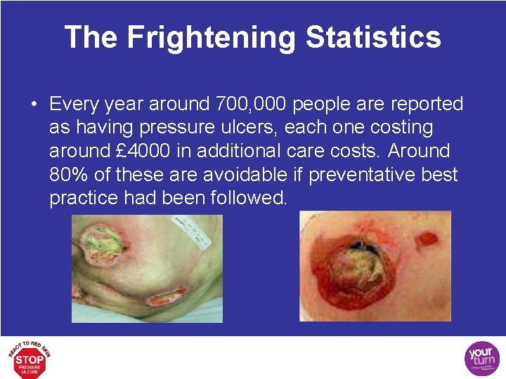 The Frightening Statistics • Every year around 700, 000 people are reported as having