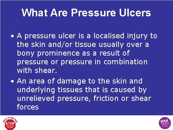 What Are Pressure Ulcers • A pressure ulcer is a localised injury to the