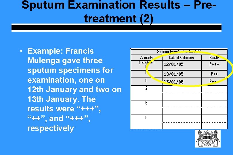 Sputum Examination Results – Pretreatment (2) • Example: Francis Mulenga gave three sputum specimens