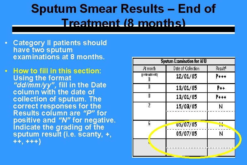 Sputum Smear Results – End of Treatment (8 months) • Category II patients should