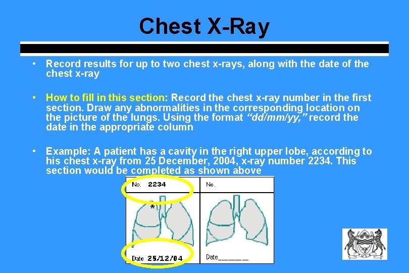 Chest X-Ray • Record results for up to two chest x-rays, along with the