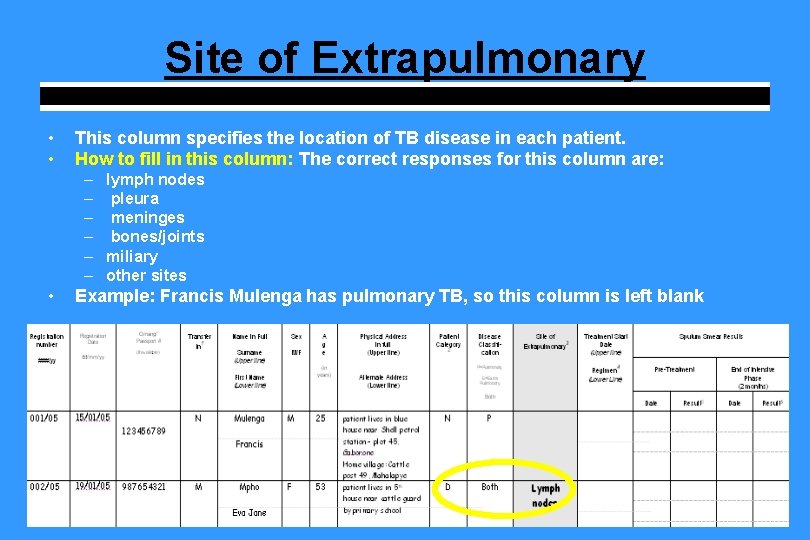 Site of Extrapulmonary • • This column specifies the location of TB disease in