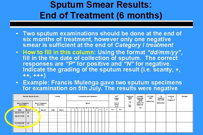 Sputum Smear Results: End of Treatment (6 months) • Two sputum examinations should be