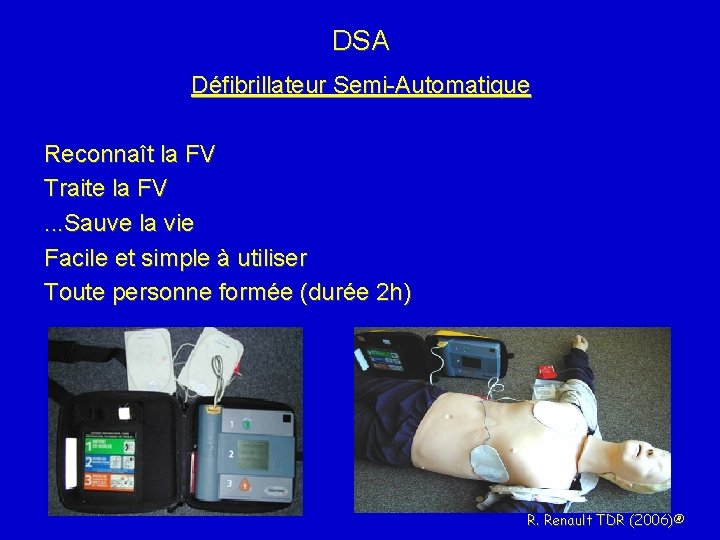 DSA Défibrillateur Semi-Automatique Reconnaît la FV Traite la FV. . . Sauve la vie