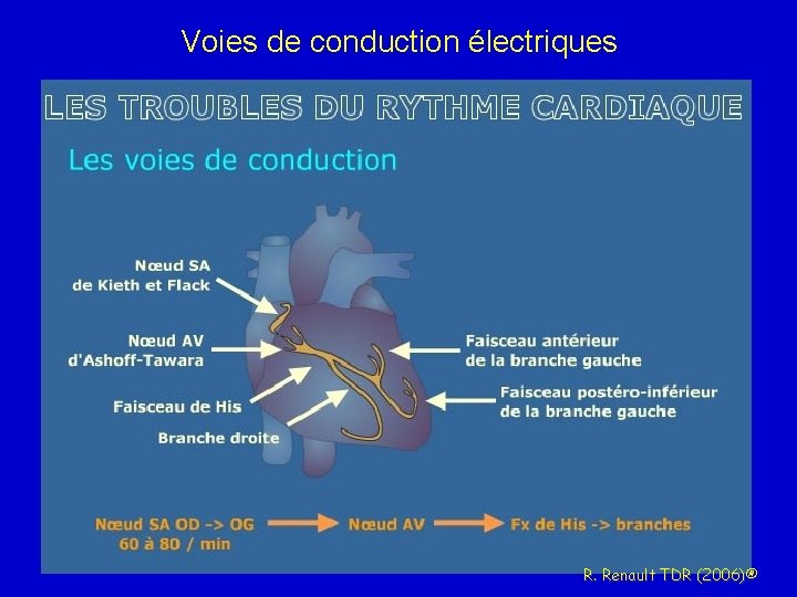 Voies de conduction électriques R. Renault TDR (2006)® 
