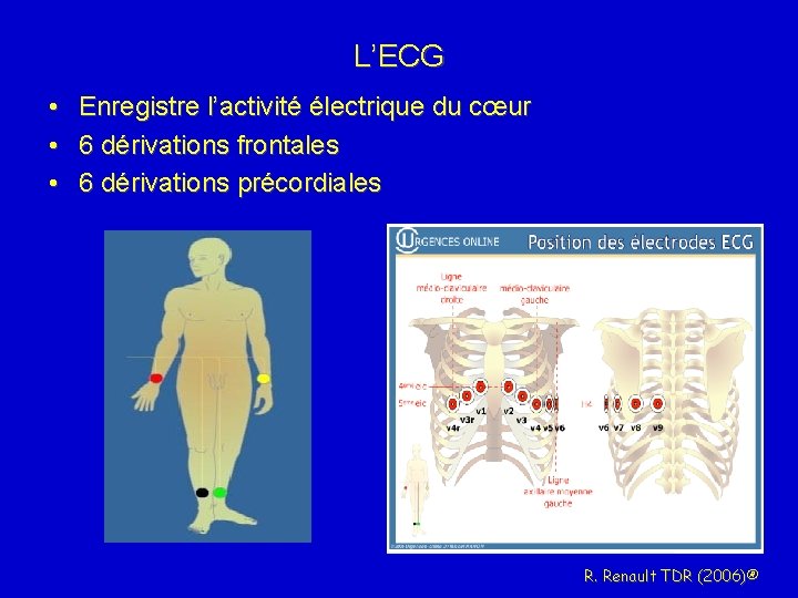 L’ECG • Enregistre l’activité électrique du cœur • 6 dérivations frontales • 6 dérivations