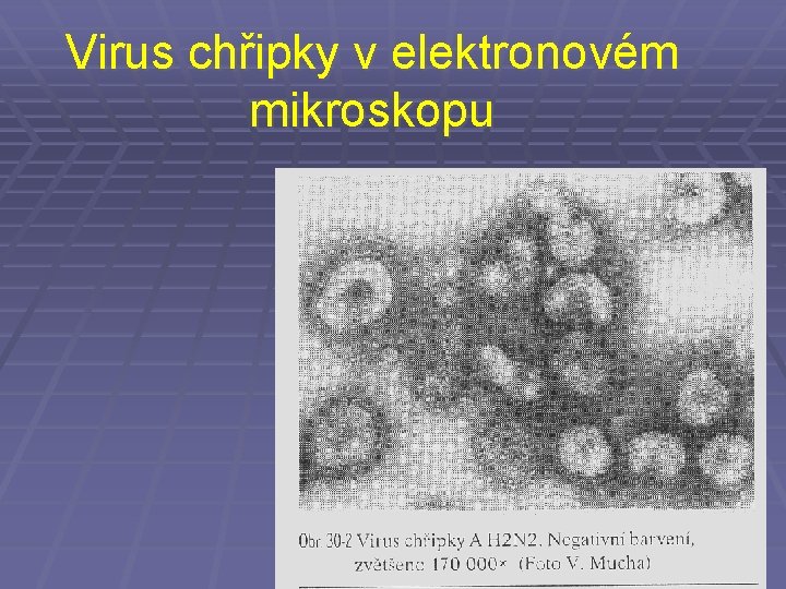 Virus chřipky v elektronovém mikroskopu 