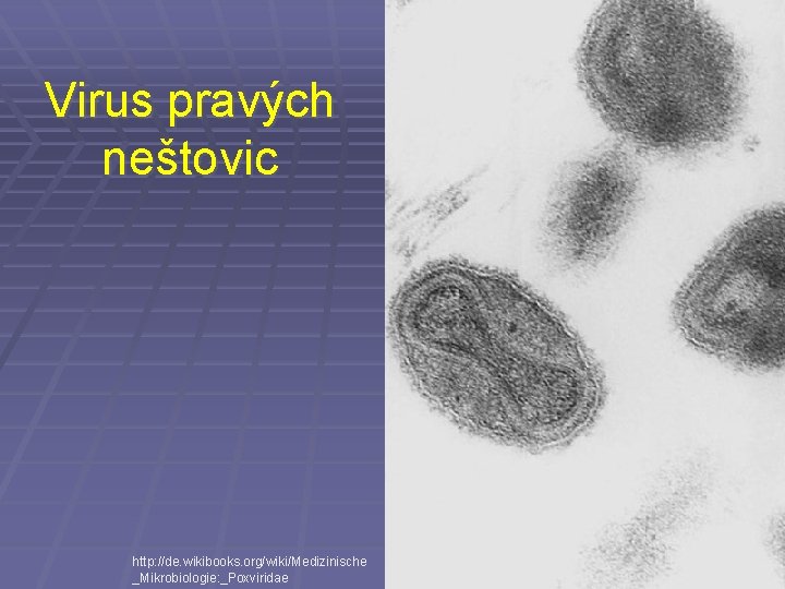 Virus pravých neštovic http: //de. wikibooks. org/wiki/Medizinische _Mikrobiologie: _Poxviridae 