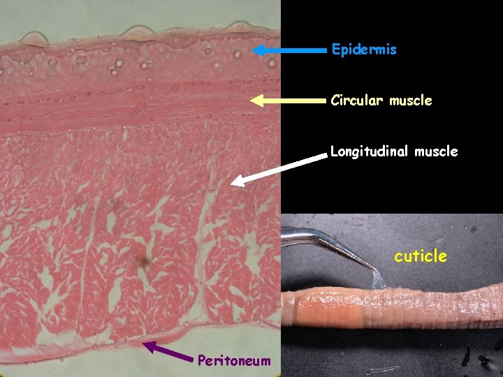 Epidermis Circular muscle Longitudinal muscle cuticle Peritoneum 