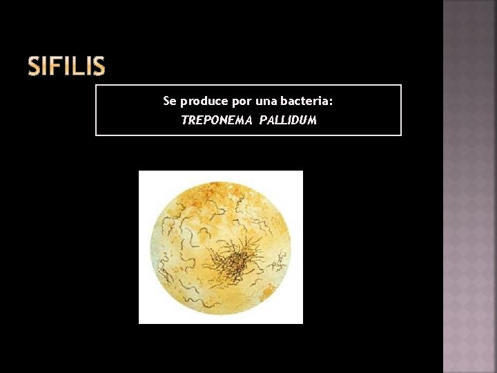Se produce por una bacteria: TREPONEMA PALLIDUM 