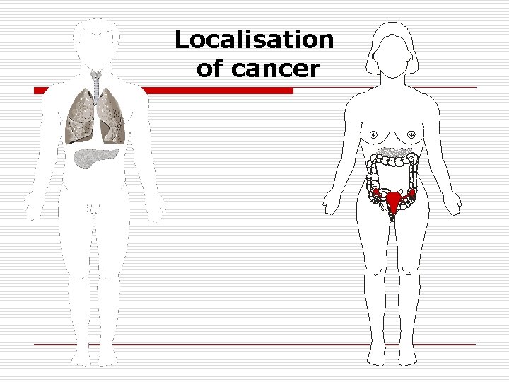 Localisation of cancer 