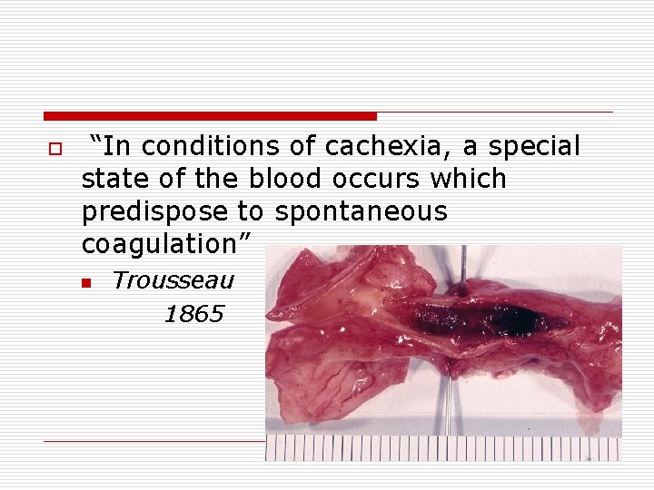 o “In conditions of cachexia, a special state of the blood occurs which predispose